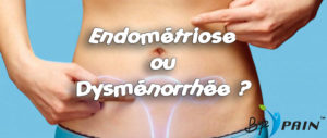endométriose ou dysménorrhée